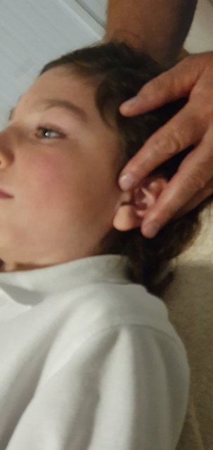Treatment of vertigo (and tinnitus, hearing loss, shoulder pain and restricted movement, as well as teeth grinding and rigid tension states throughout the body)!